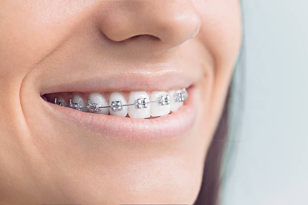 Best Orthodontics  in Escondido, CA